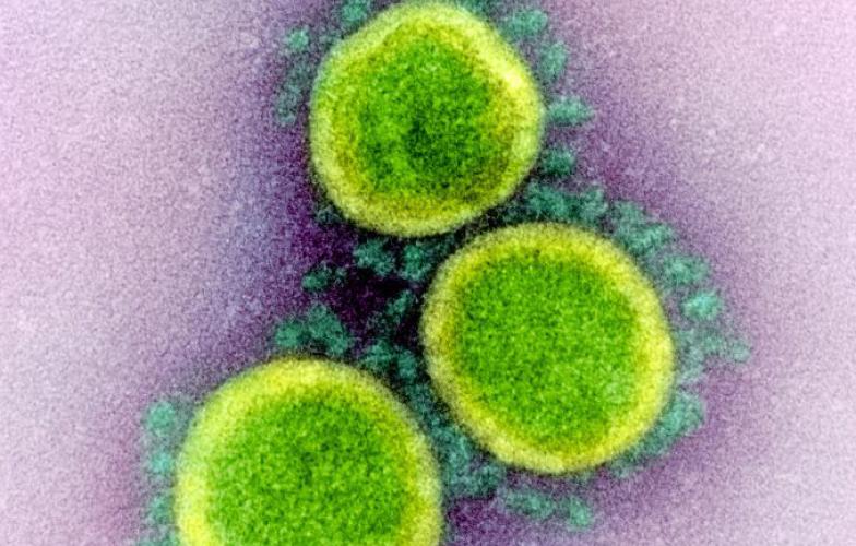 Novel Coronavirus SARS-CoV-2