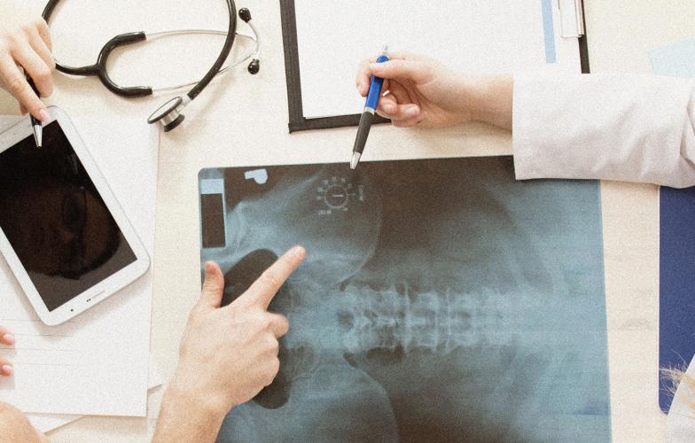 Doctors discussing a patient X-ray. 