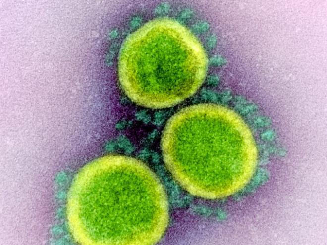 Novel Coronavirus SARS-CoV-2