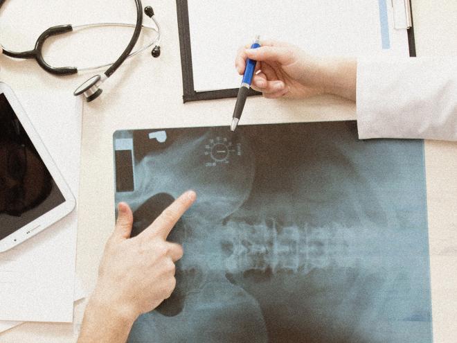 Doctors discussing a patient X-ray. 