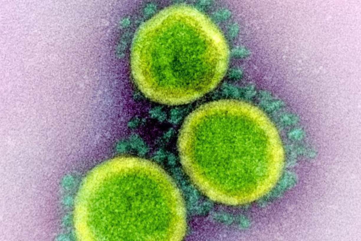 Novel Coronavirus SARS-CoV-2