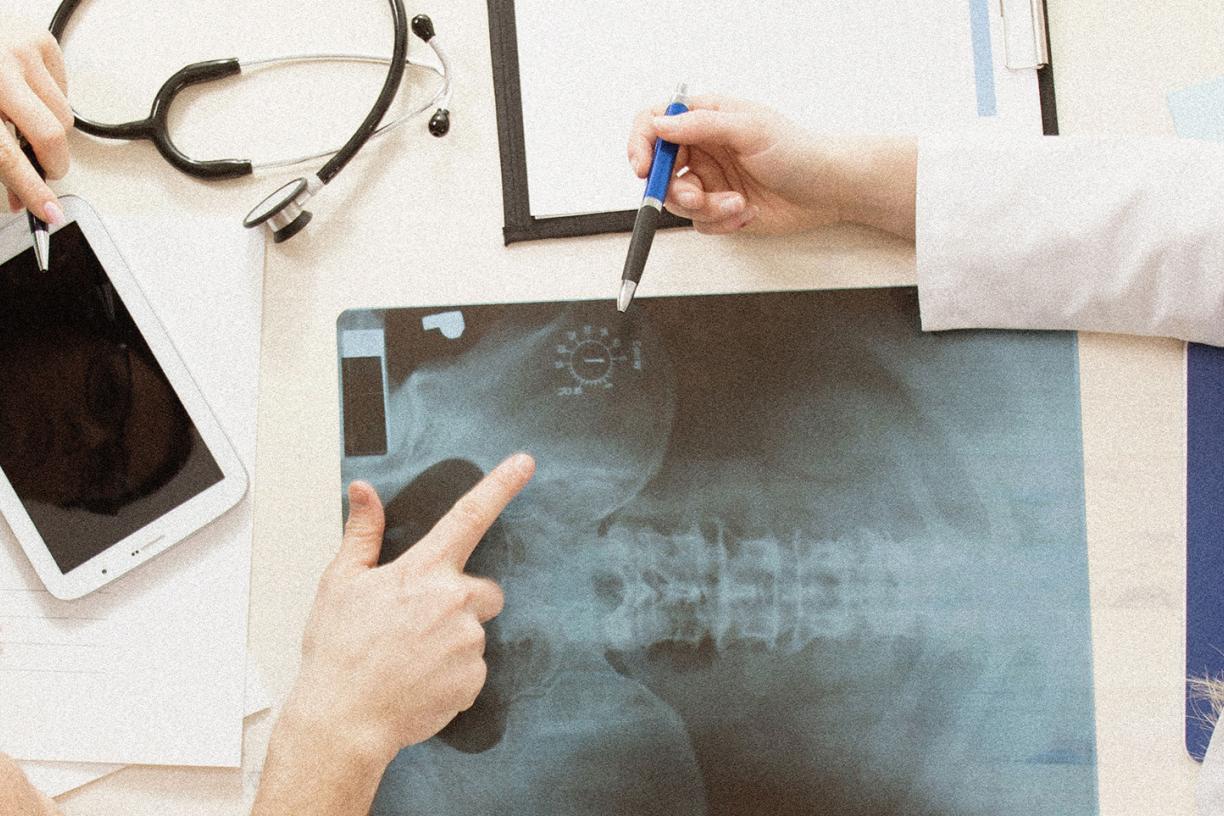 Doctors discussing a patient X-ray. 